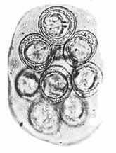 Wurmei von Dipylidium